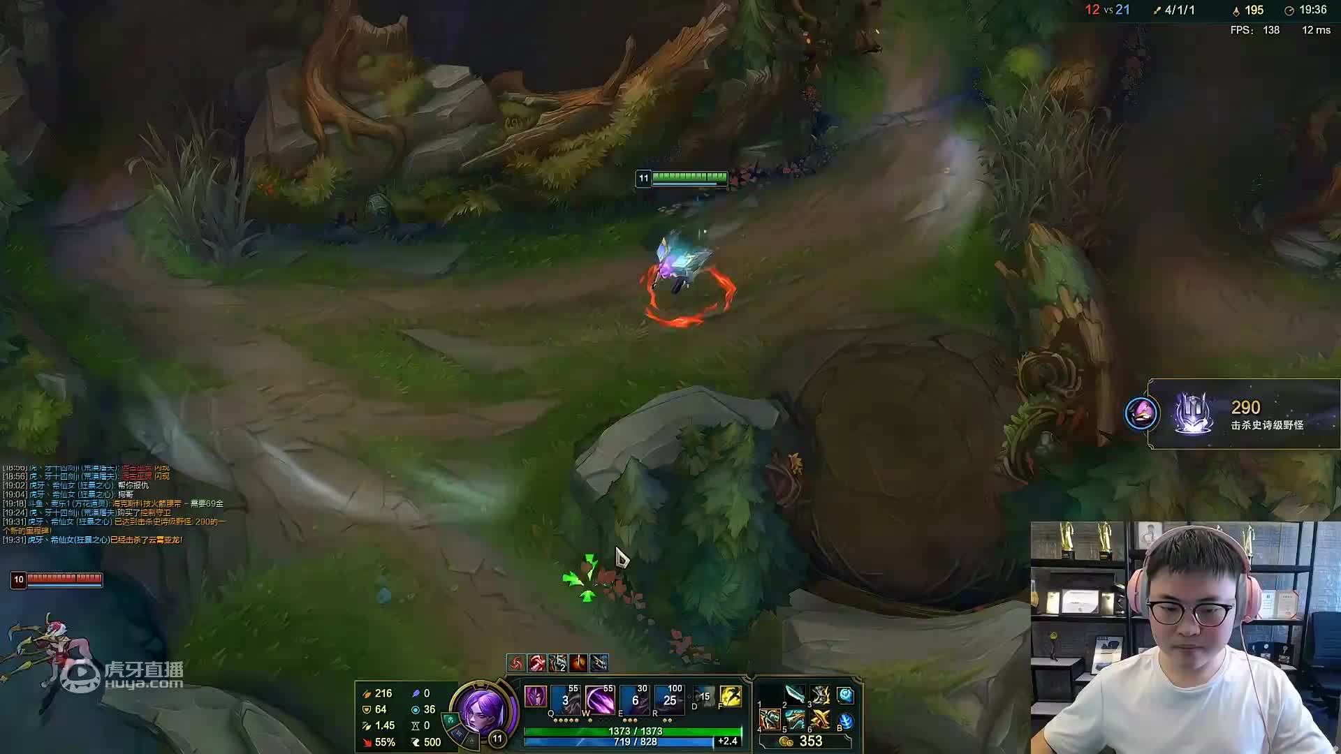 我是一颗小虎牙